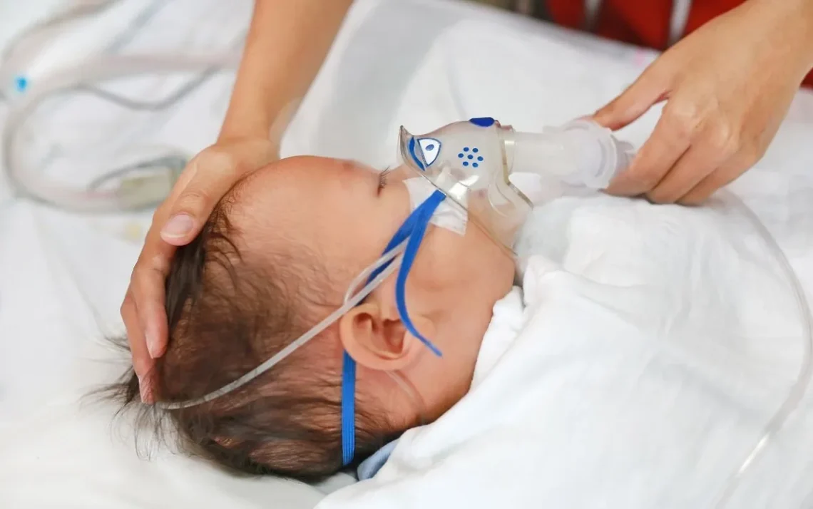 doença respiratória, infecção bronquíolos, infecção respiratória;